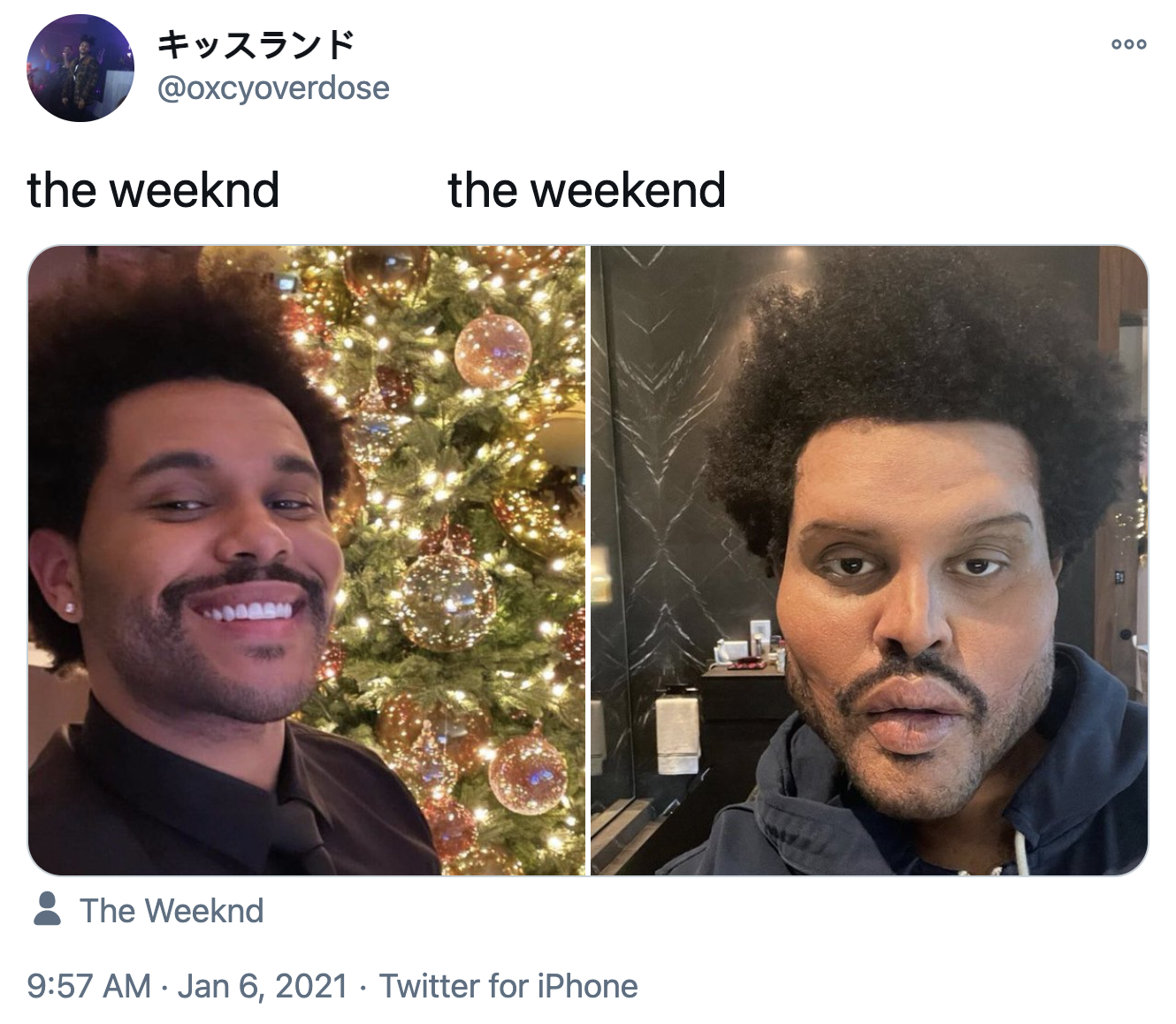Weekend Face Surgery