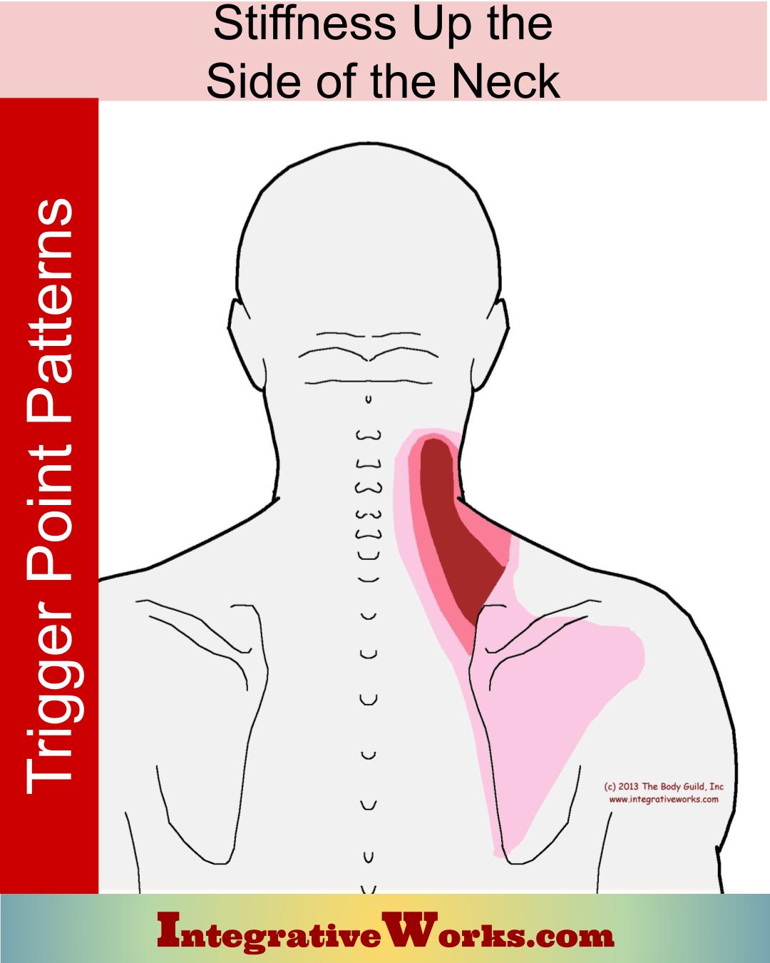 What Causes A Stiff Neck