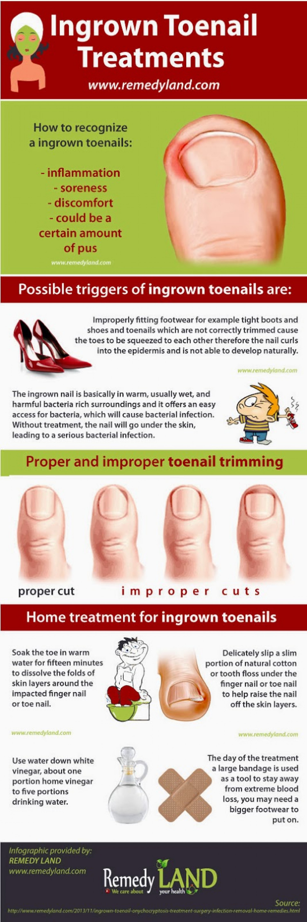 What Causes Ingrown Toenails