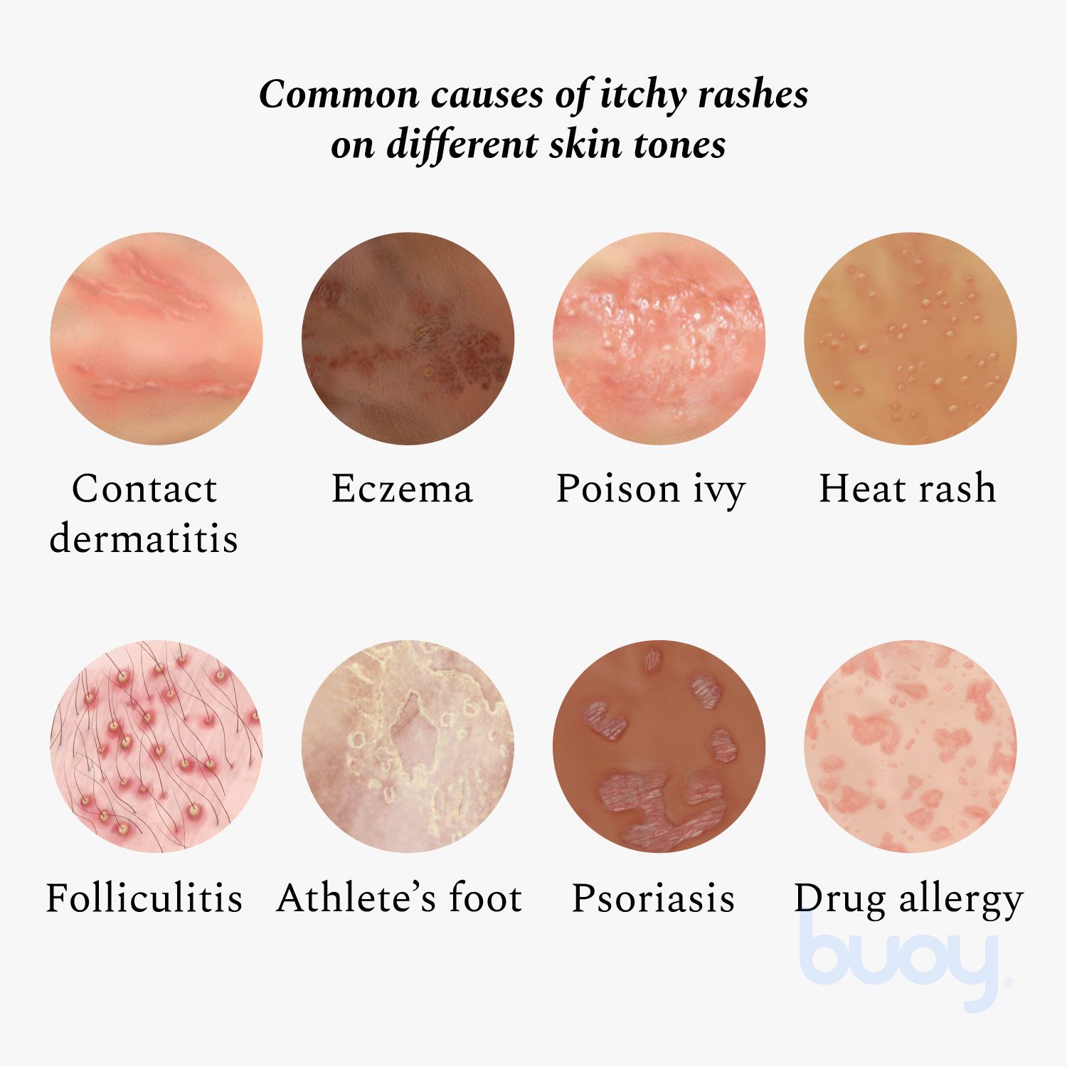 What Causes Itchy Skin