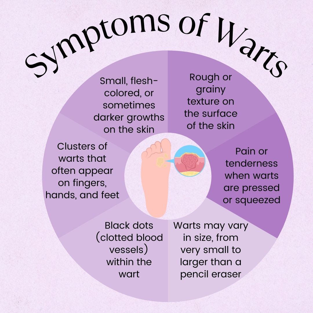 What Causes Warts