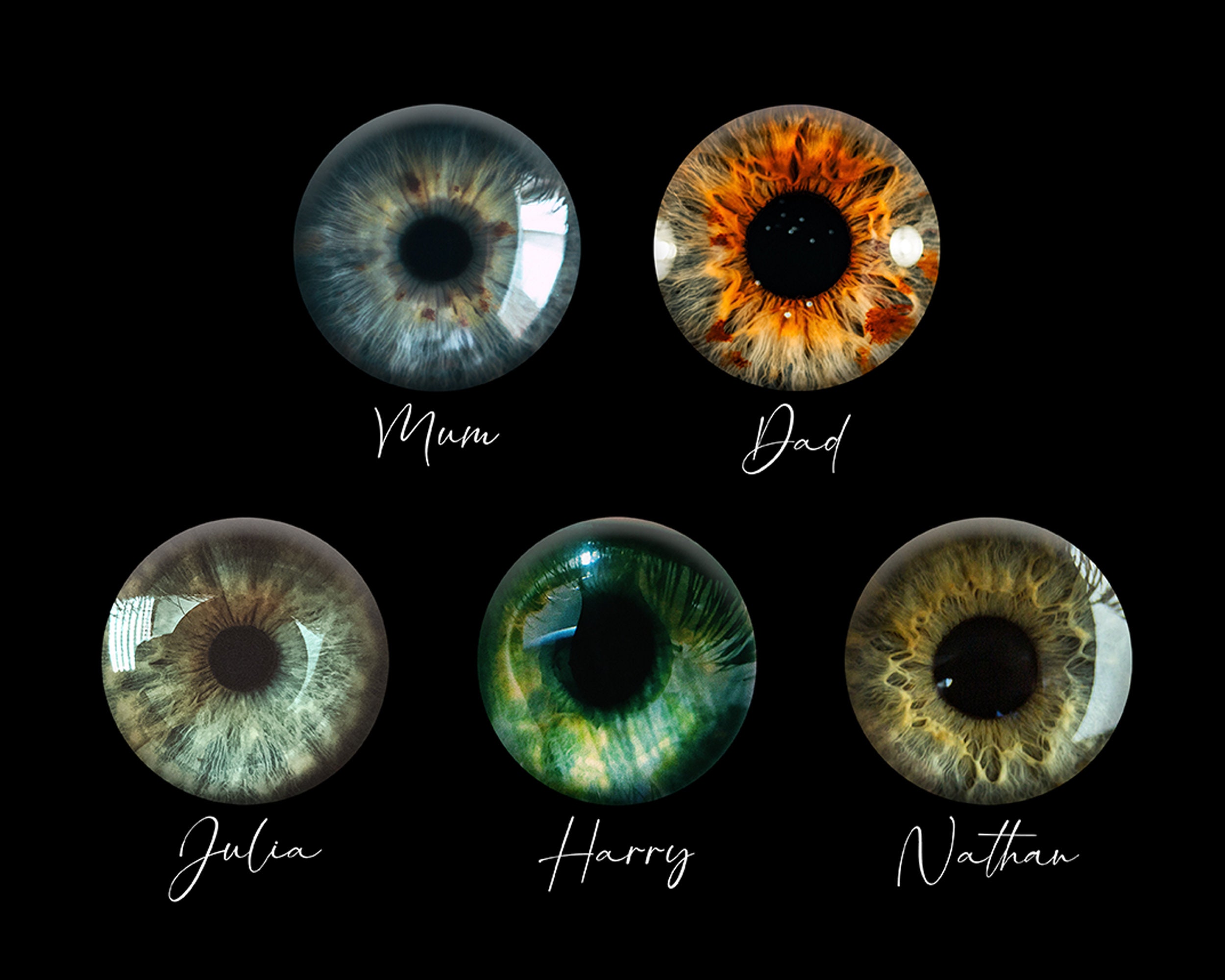 What Color Are Irises Eyesusually