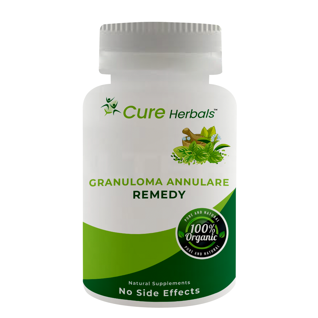 What Cures Granuloma Annulare