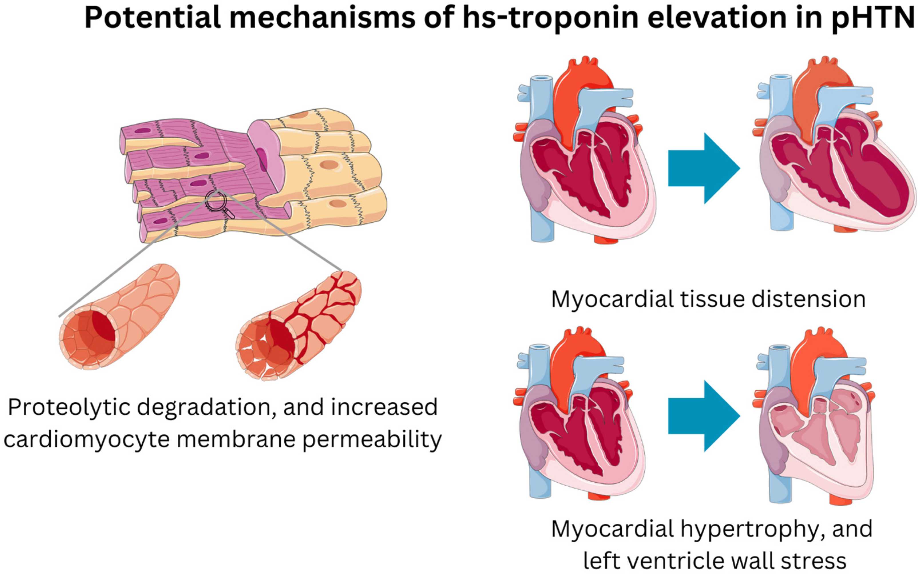 What Does Elevated Troponin Mean