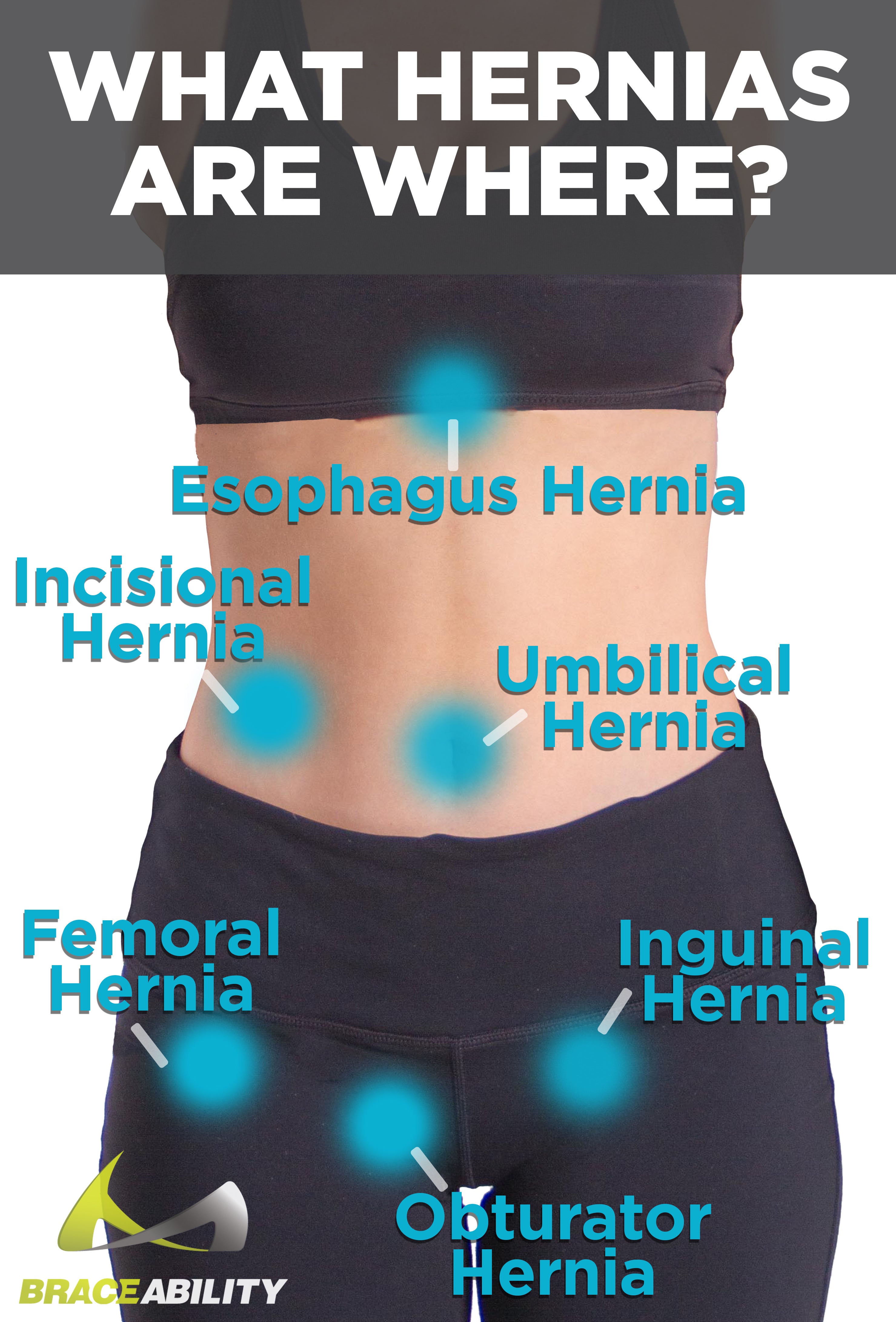 What Does Hernia Feel Like