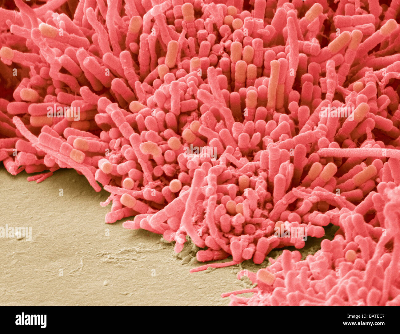 What Does Plaque Look Like