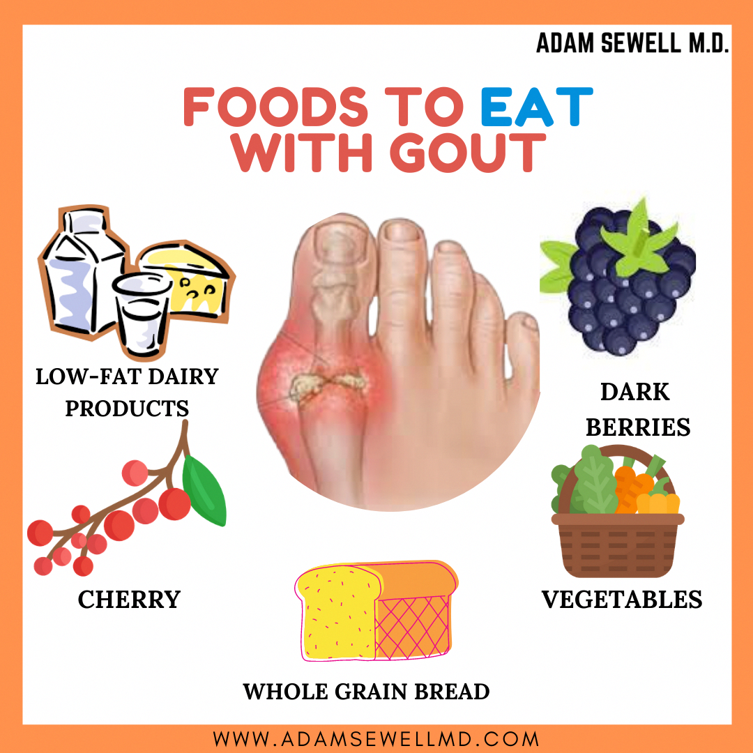 What Helps With Gout Pain