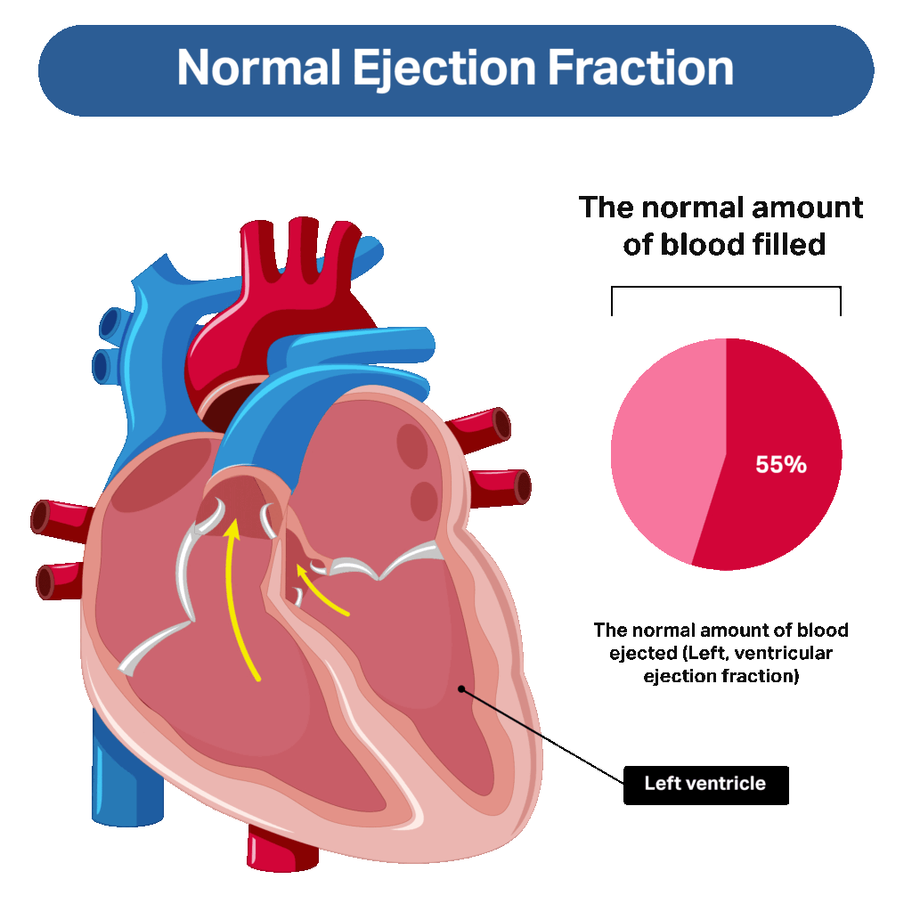 What Improves Ejection Fraction