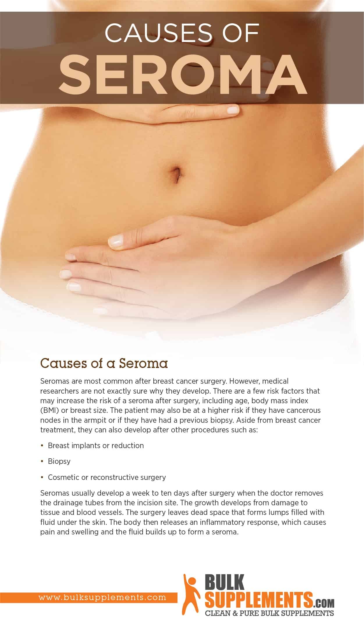 What Is A Seroma