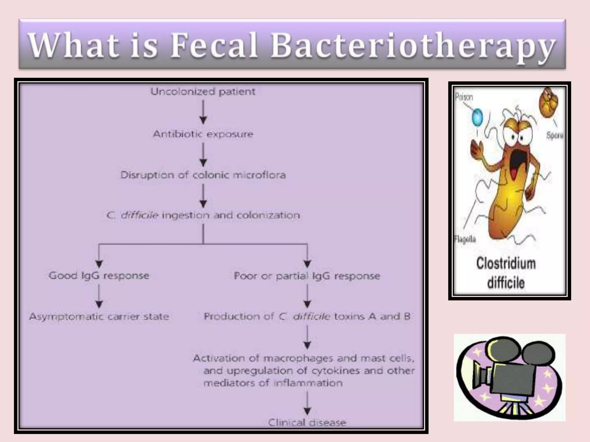 What Is Fecal Bacteriotherapy
