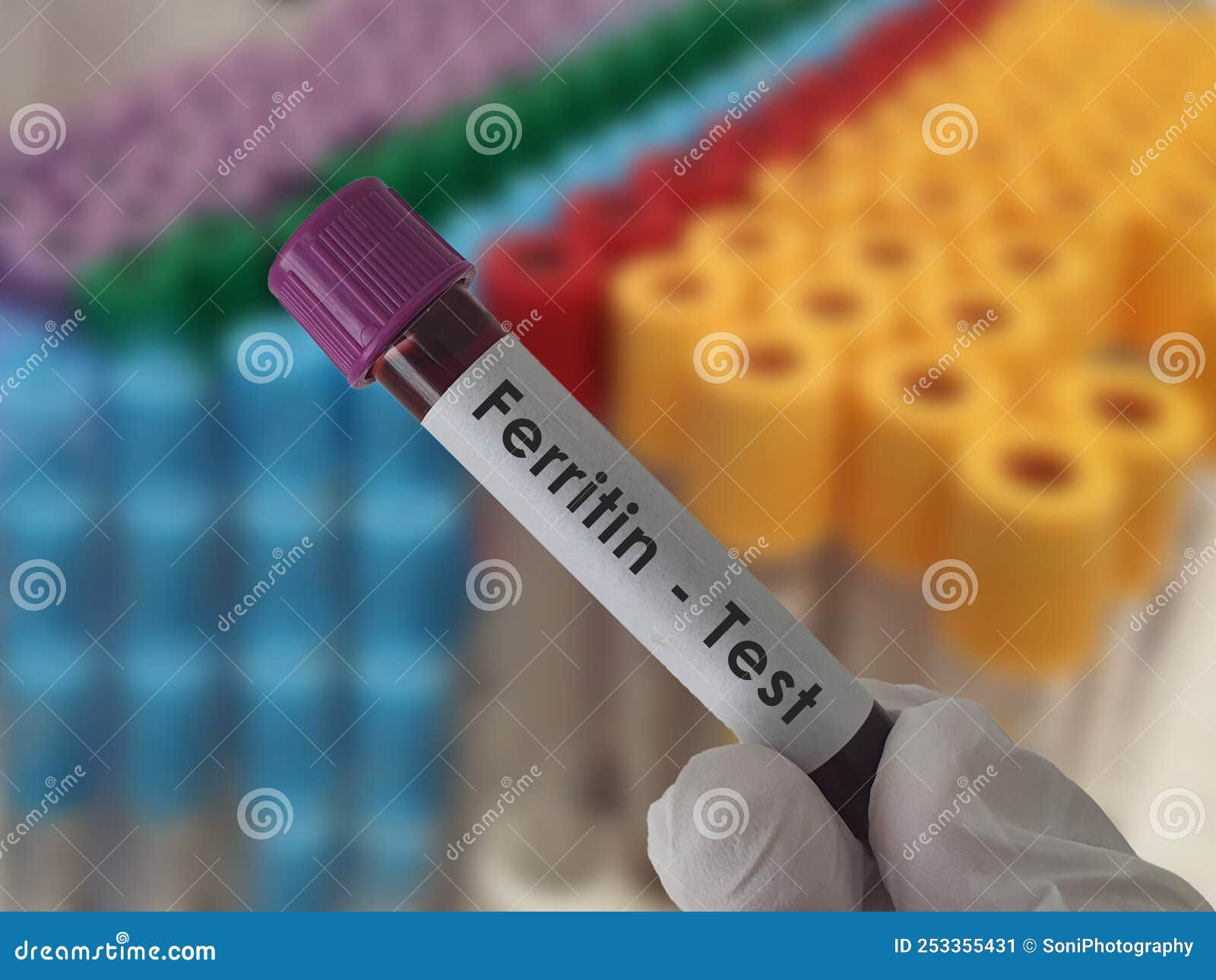 What Is Ferritin Blood Test