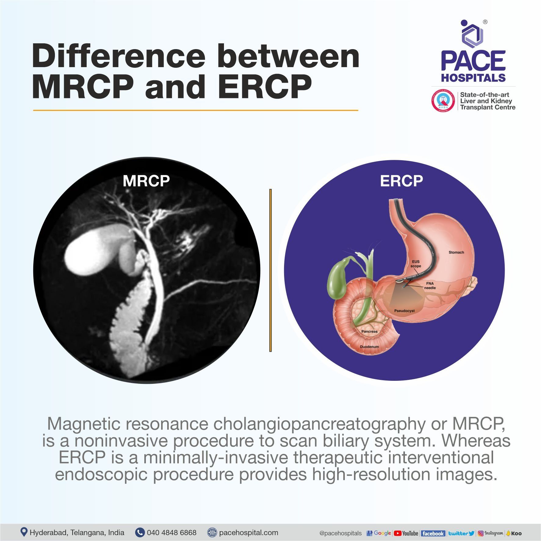 What Is Mrcp Test