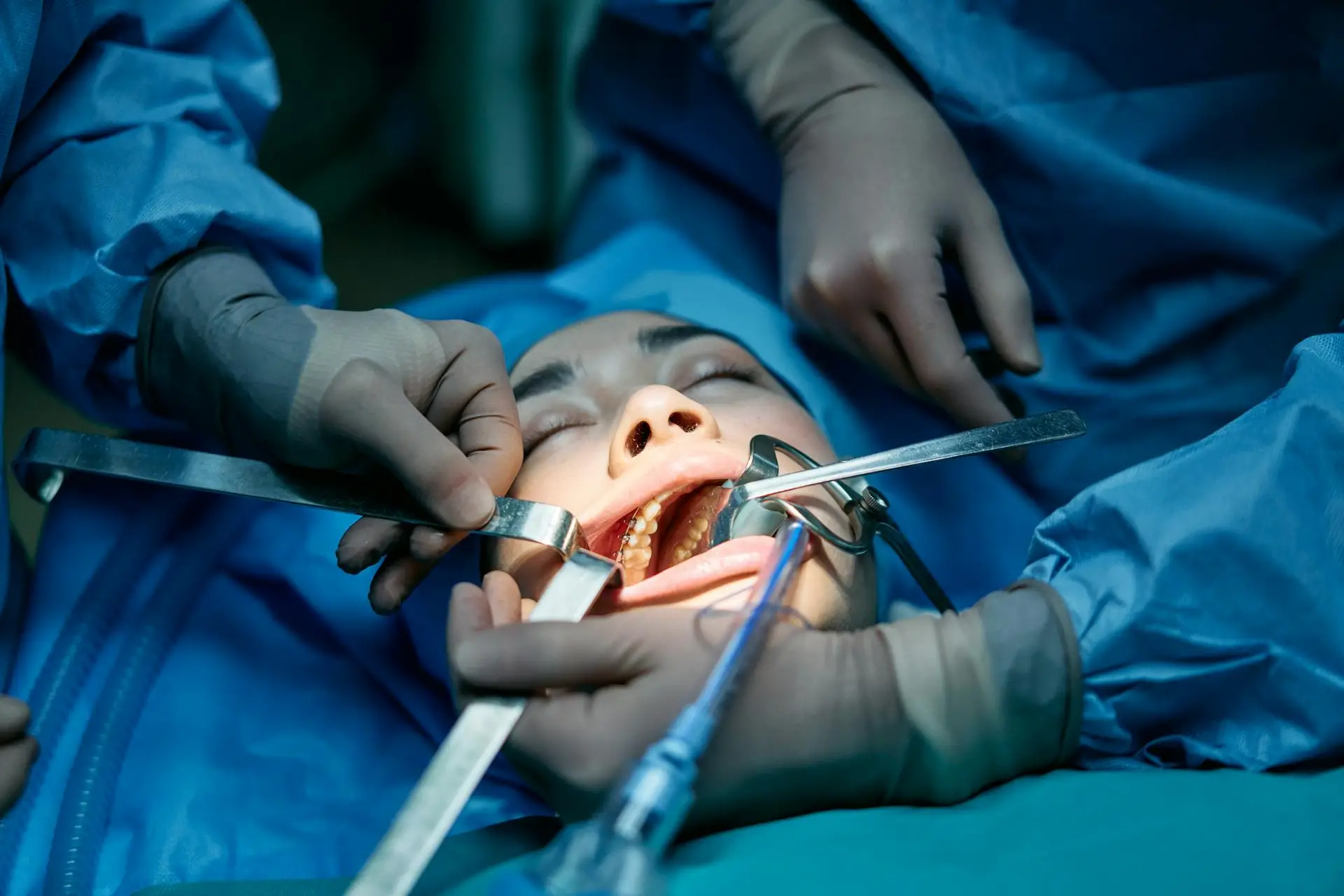 What Is Oral Surgery