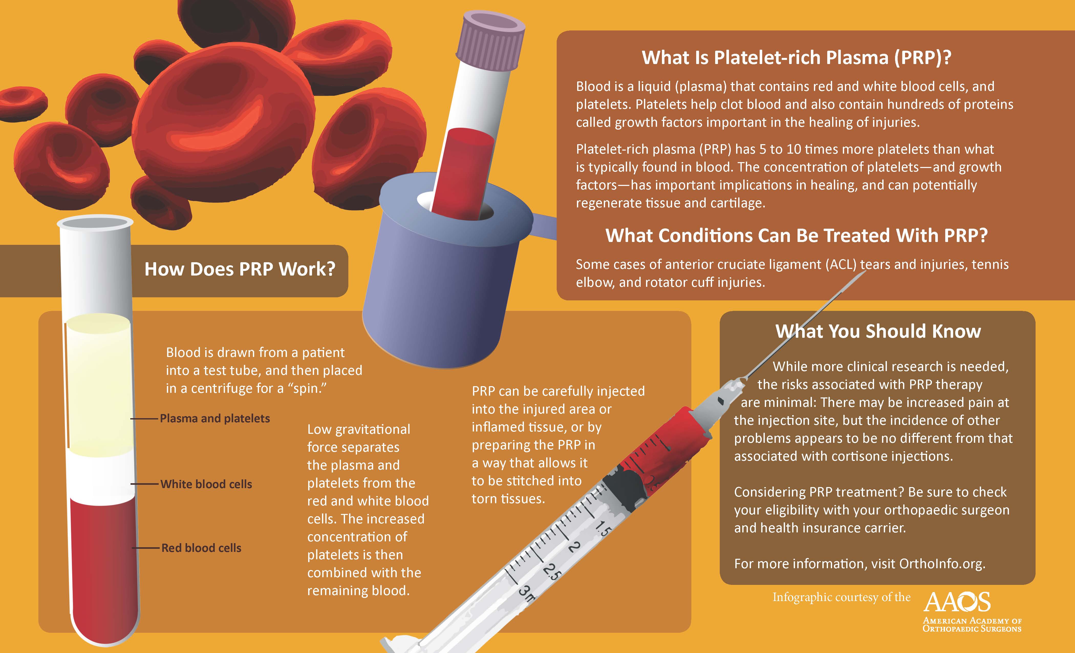 What Is Prp Treatment