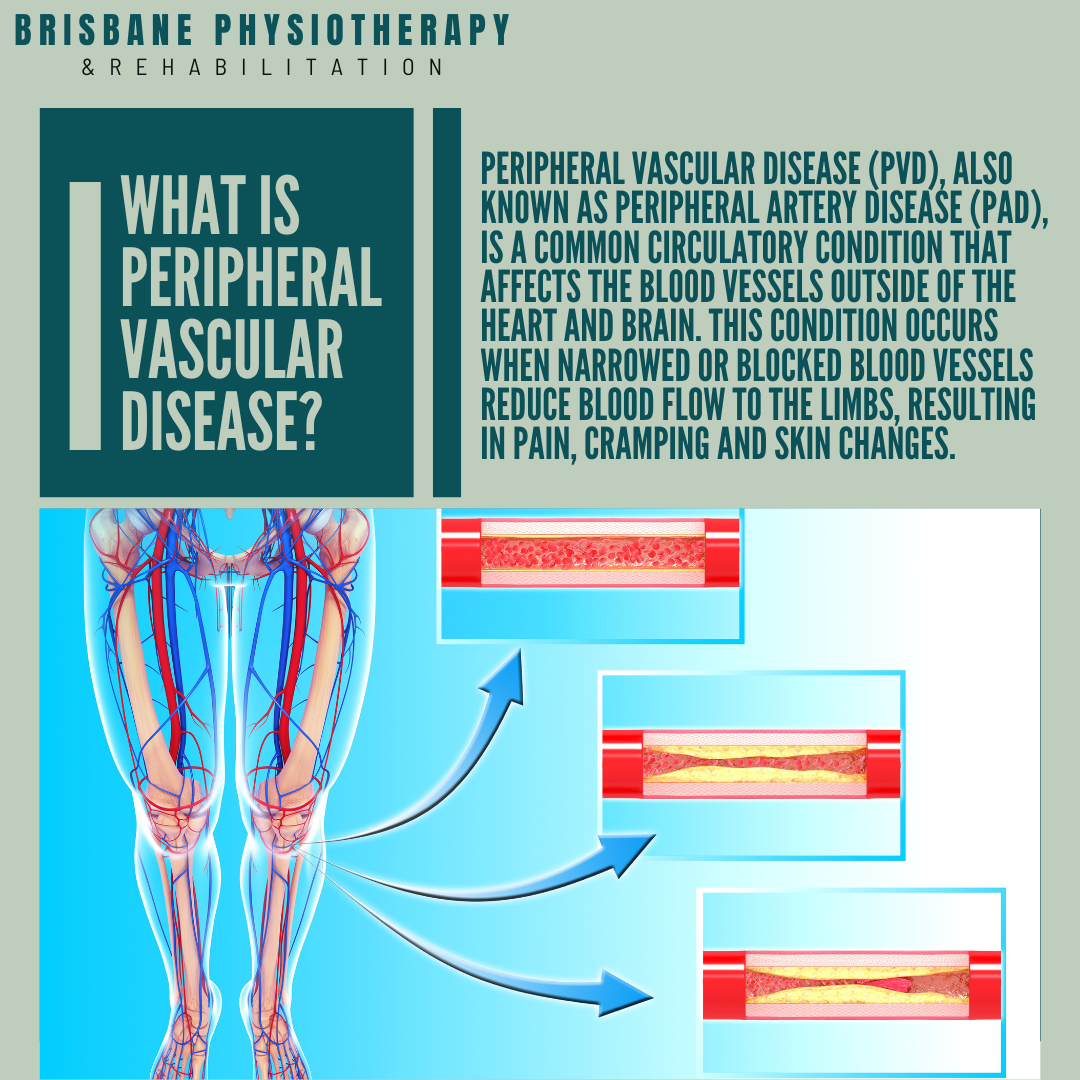 What Is Vascular Disease