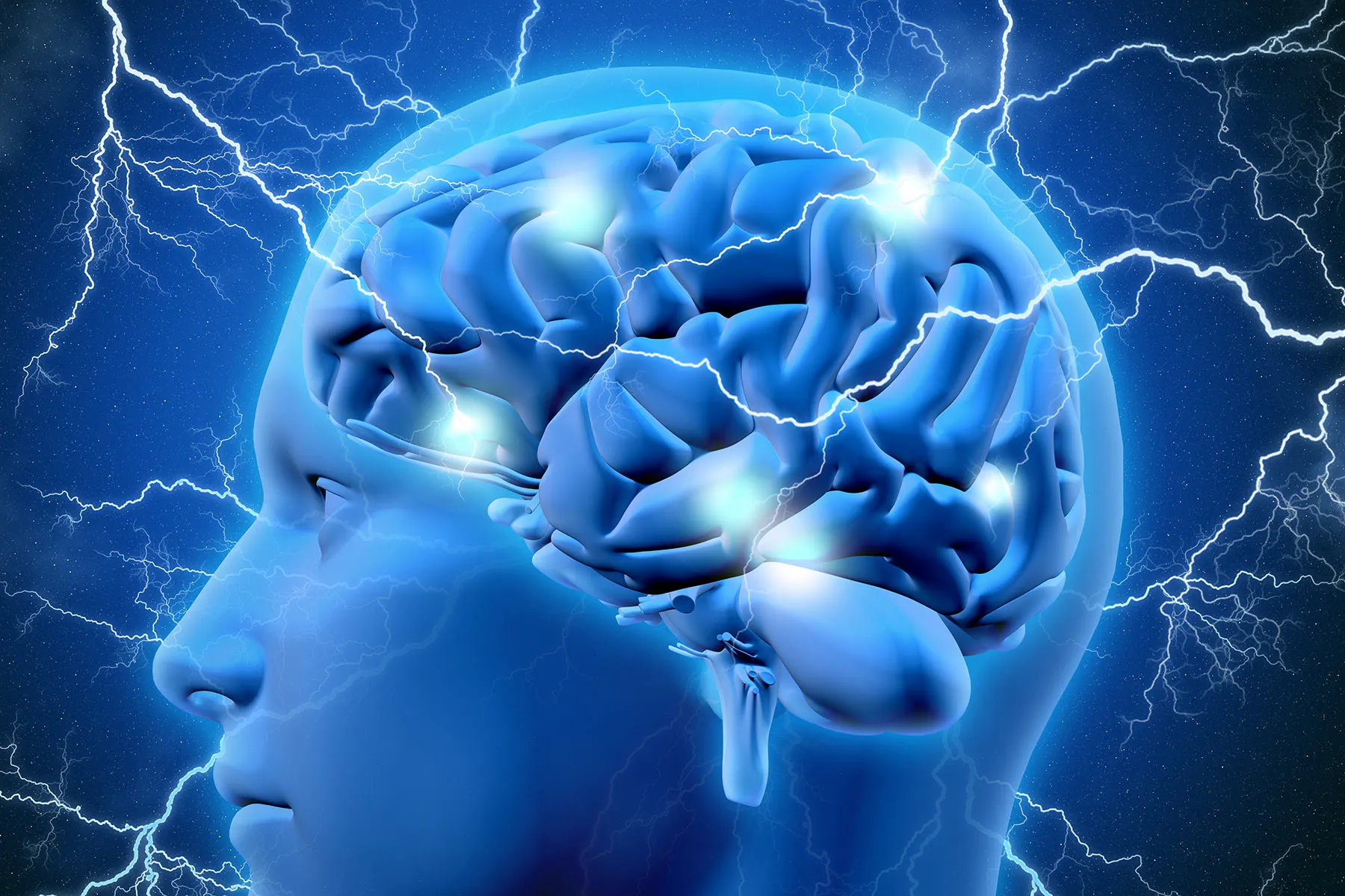 What Triggers Brain Zaps