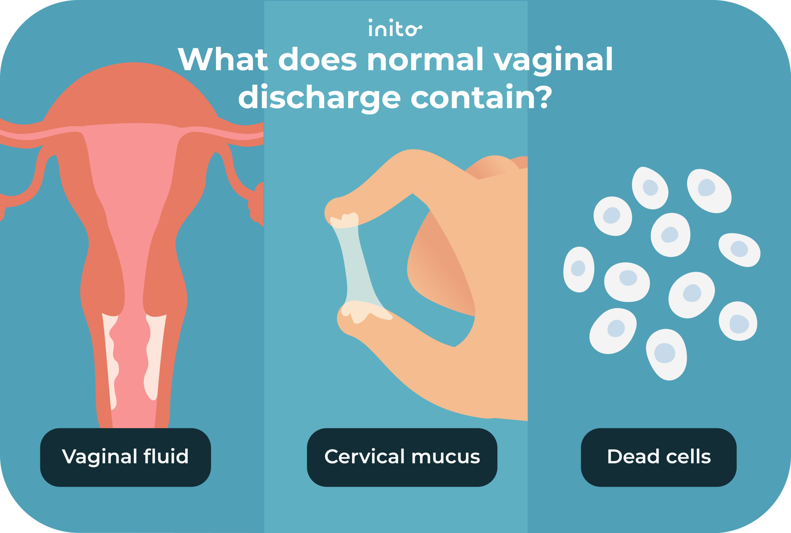 When Does Discharge Happen