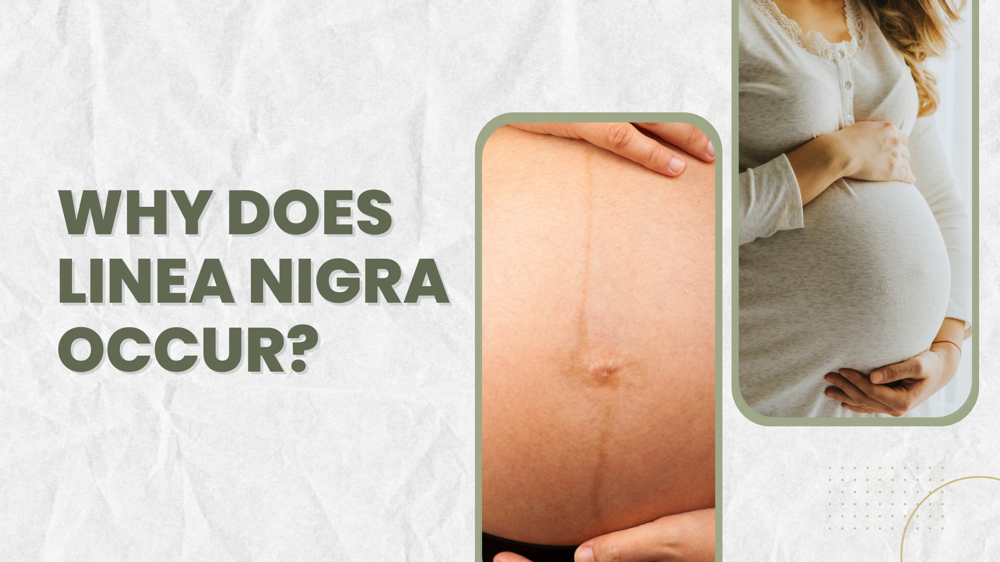 When Does Linea Nigra Appear