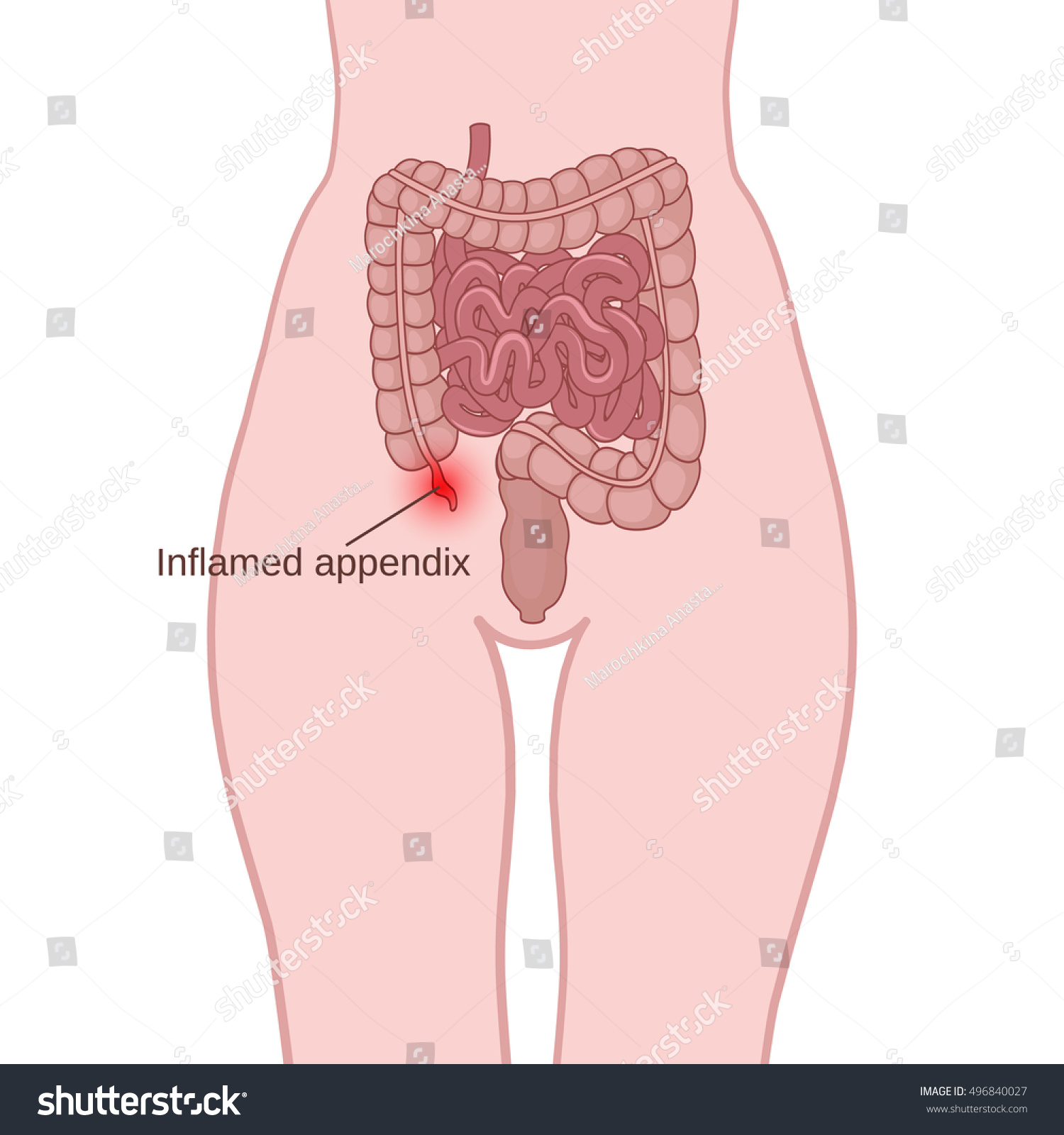 Where Are Your Appendix Located