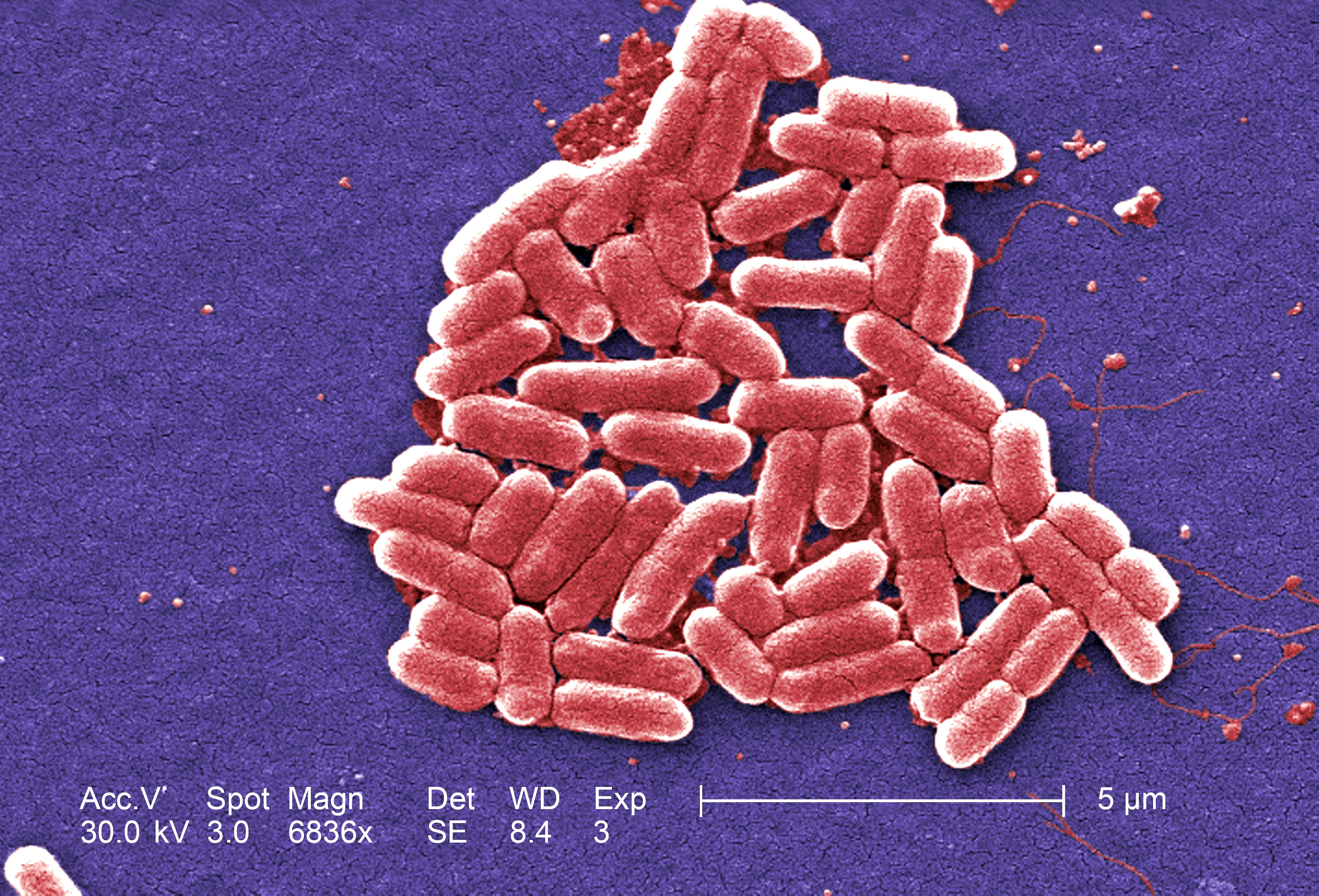 Where Is E. Coli Found