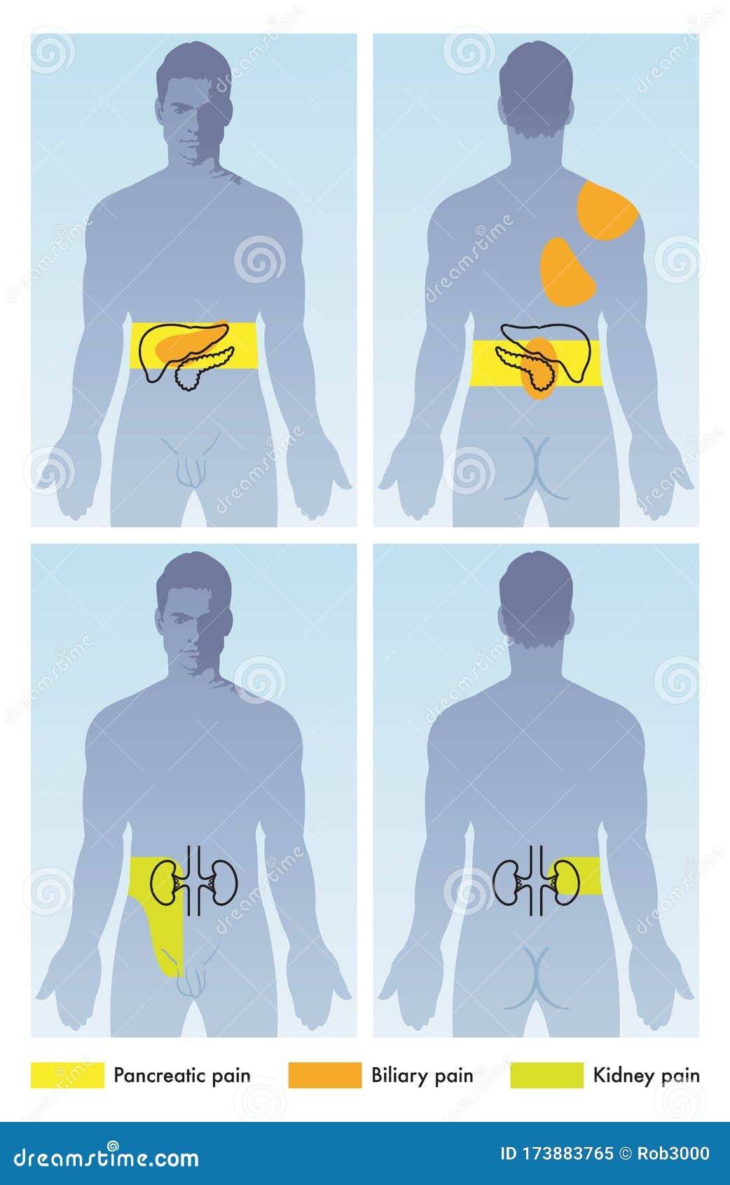 Where Is Kidney Pain Felt