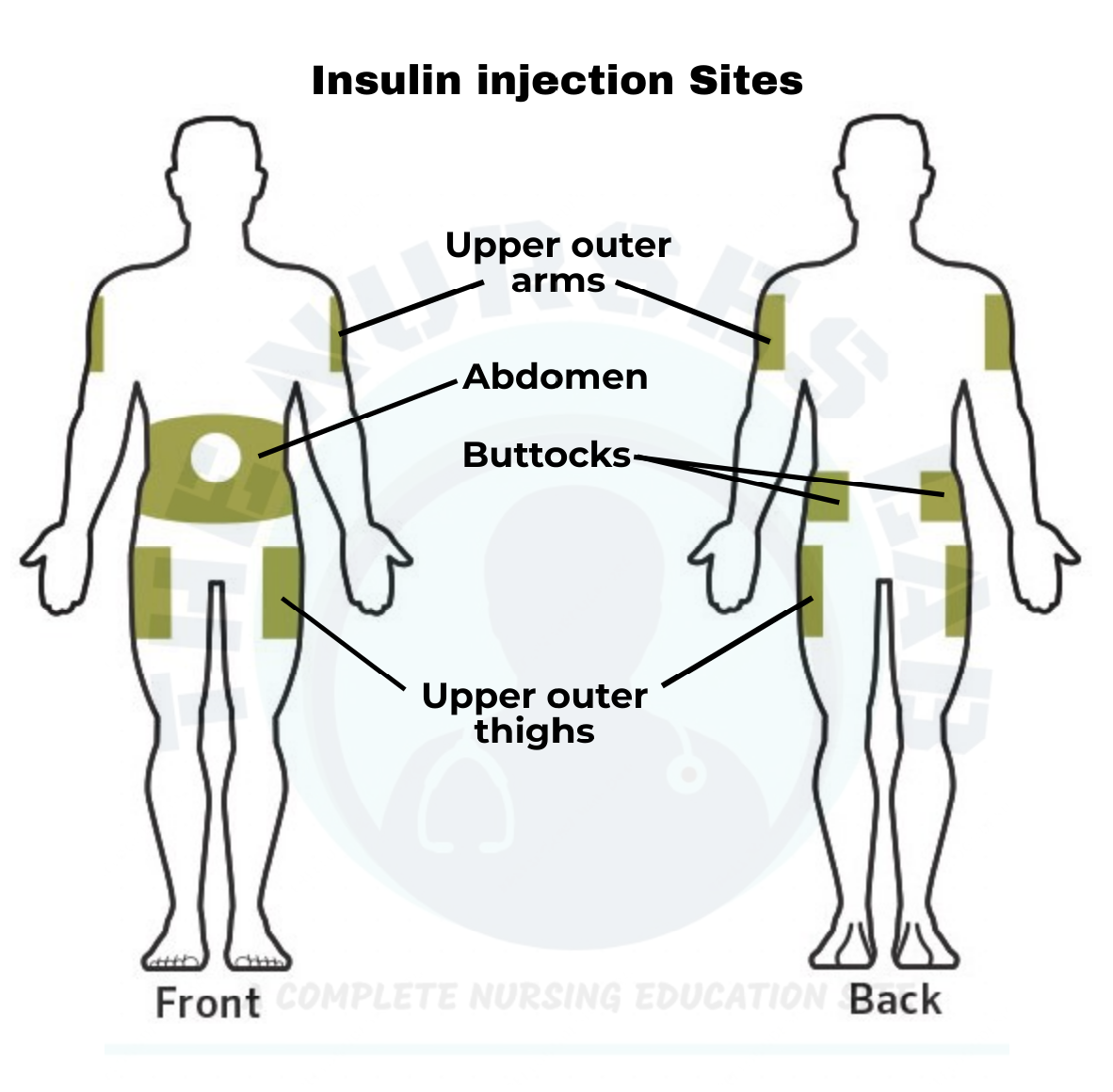 Where To Inject Insulin