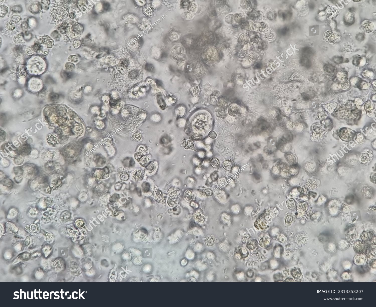 White Grains In Urine