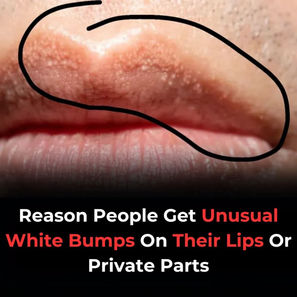 Whitish Bumps On Lips