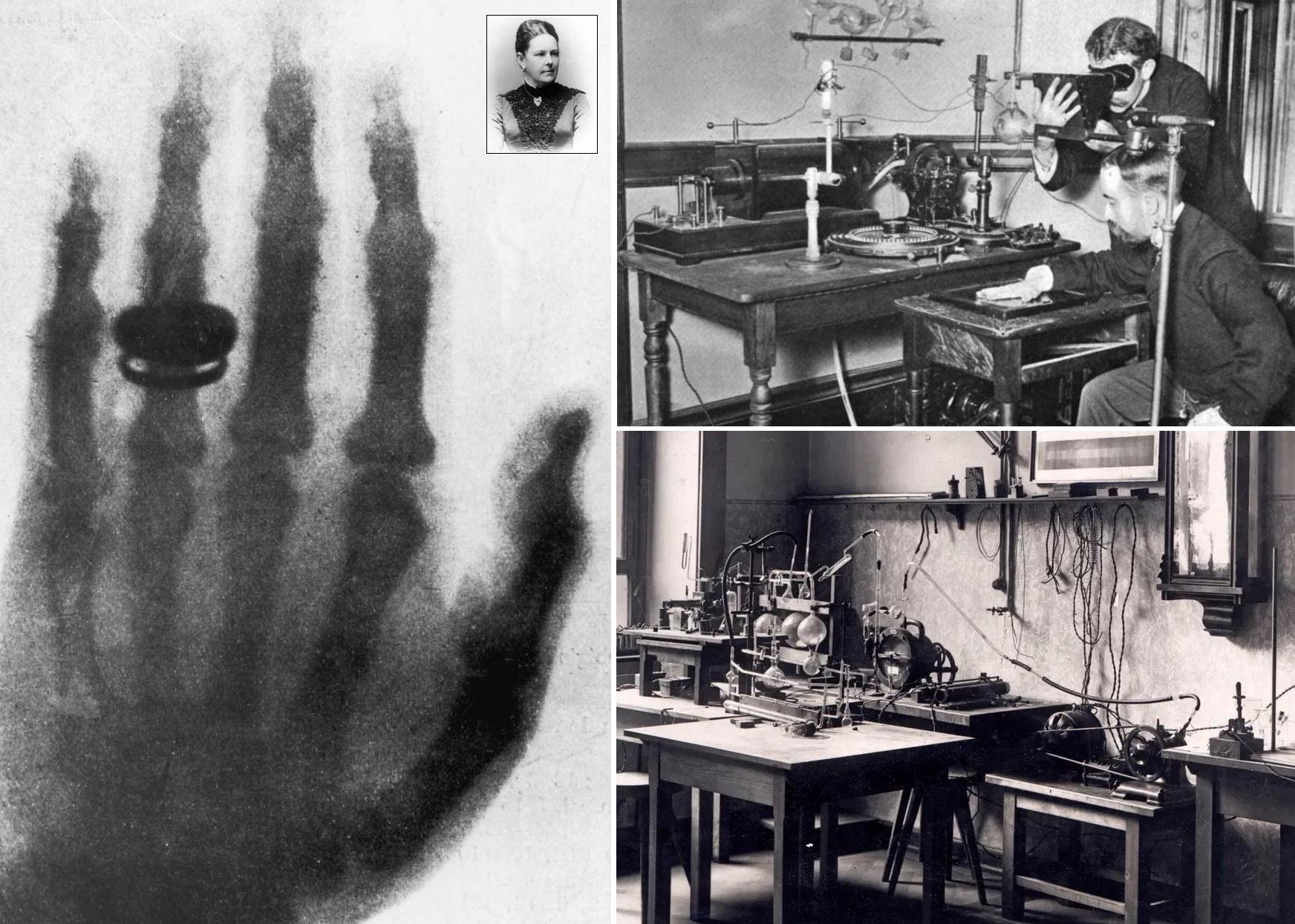 Who Invented Xray Machine