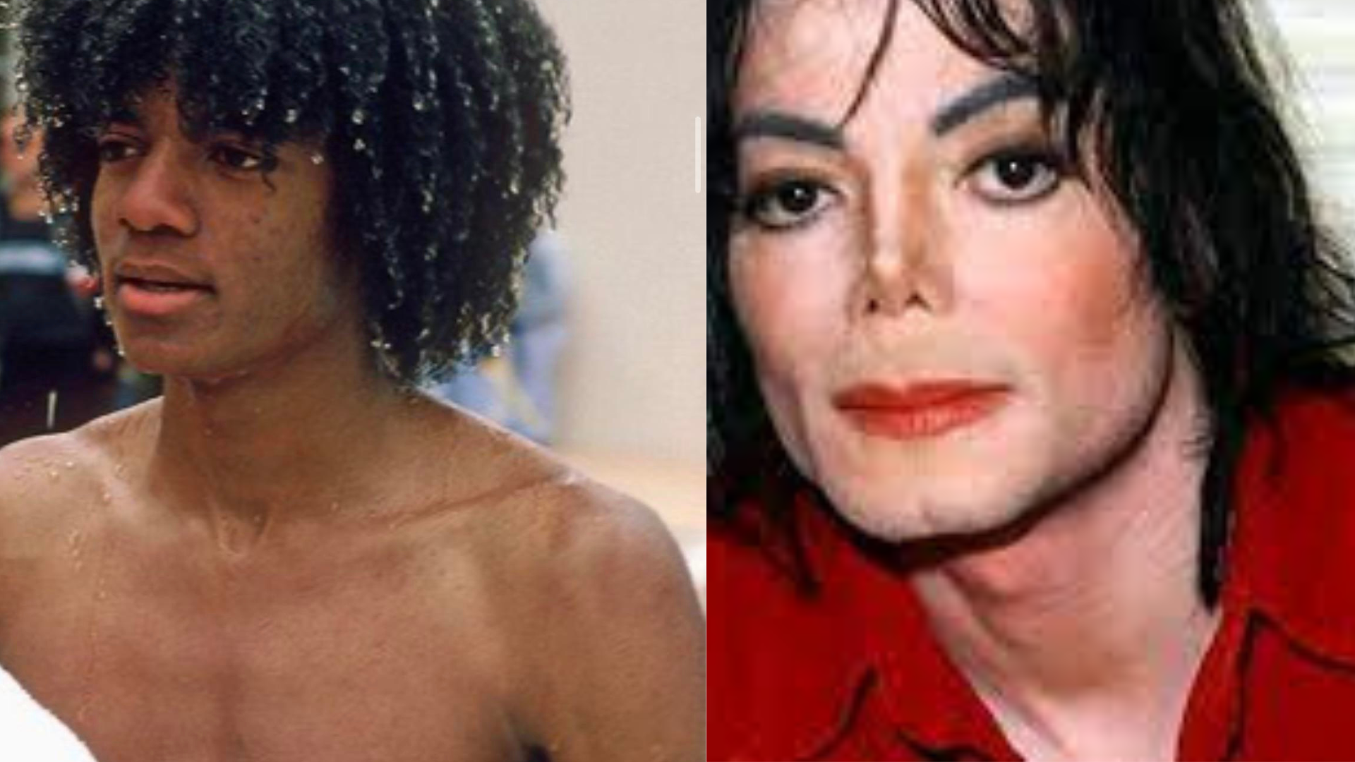 Why Did Michael Jackson Get Face Surgery