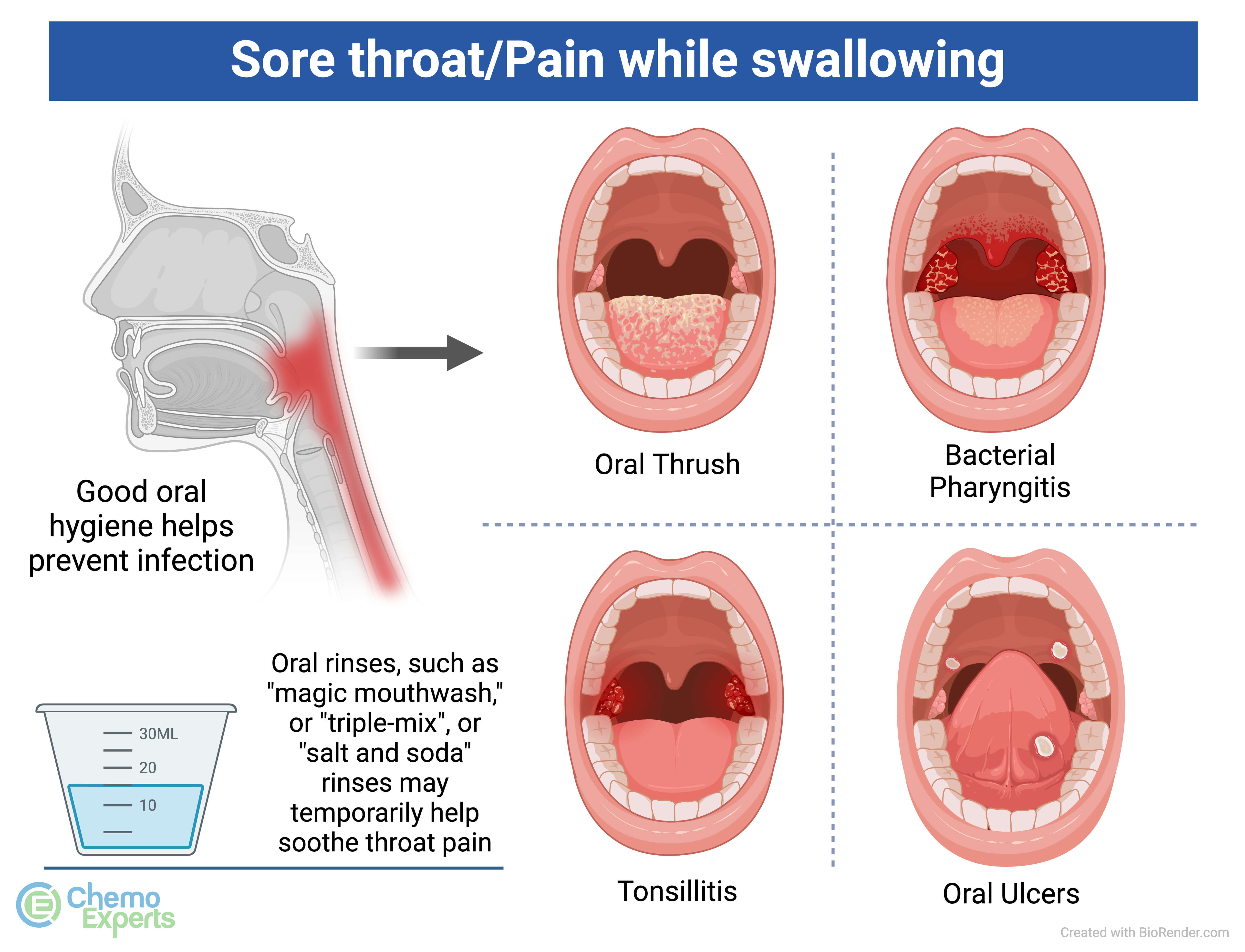 Why Does It Hurt To Swallow
