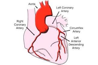Widow Maker Artery