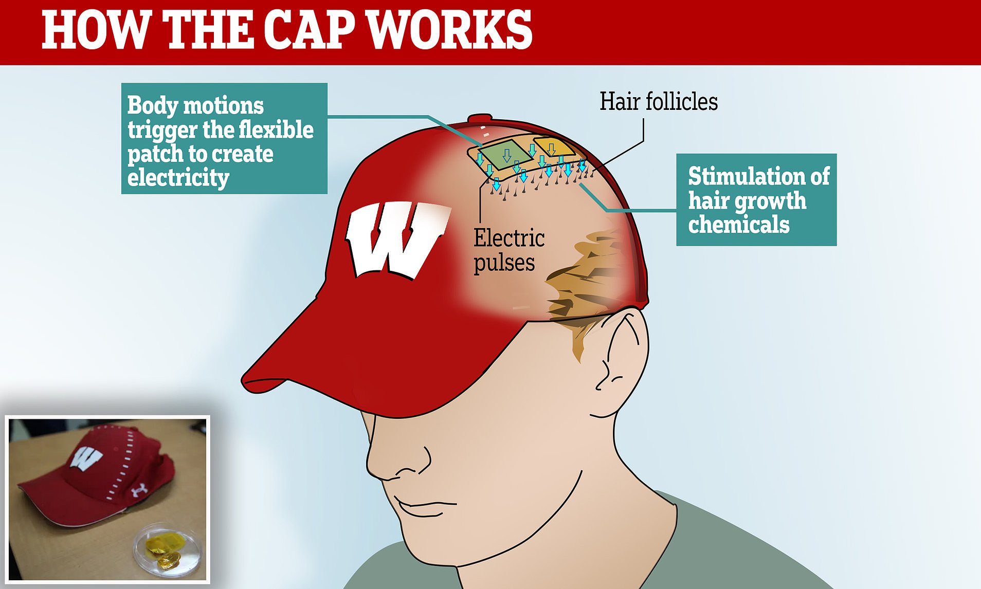 Will Hats Cause Hair Loss