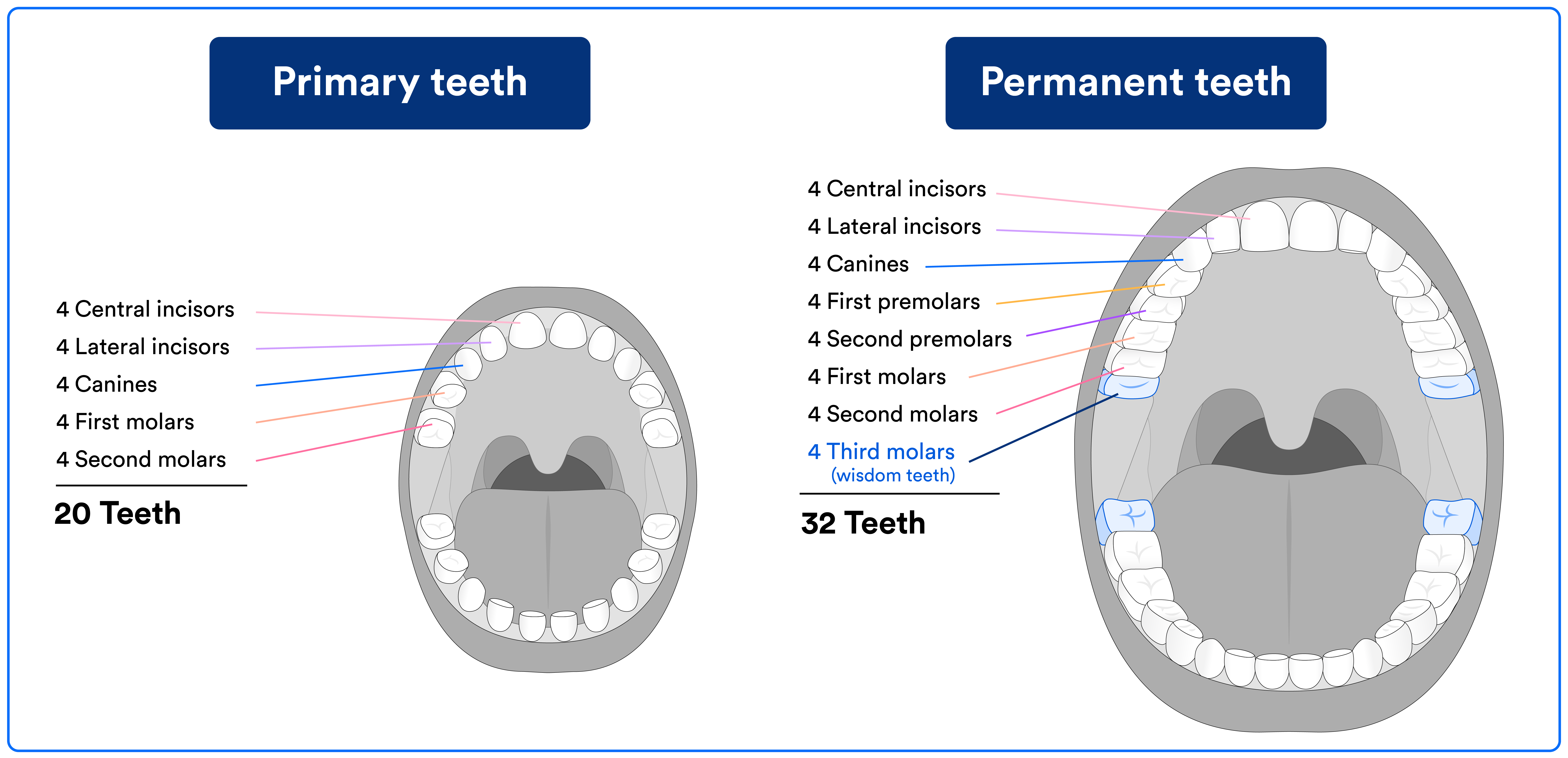 Wisdom Teeth Age