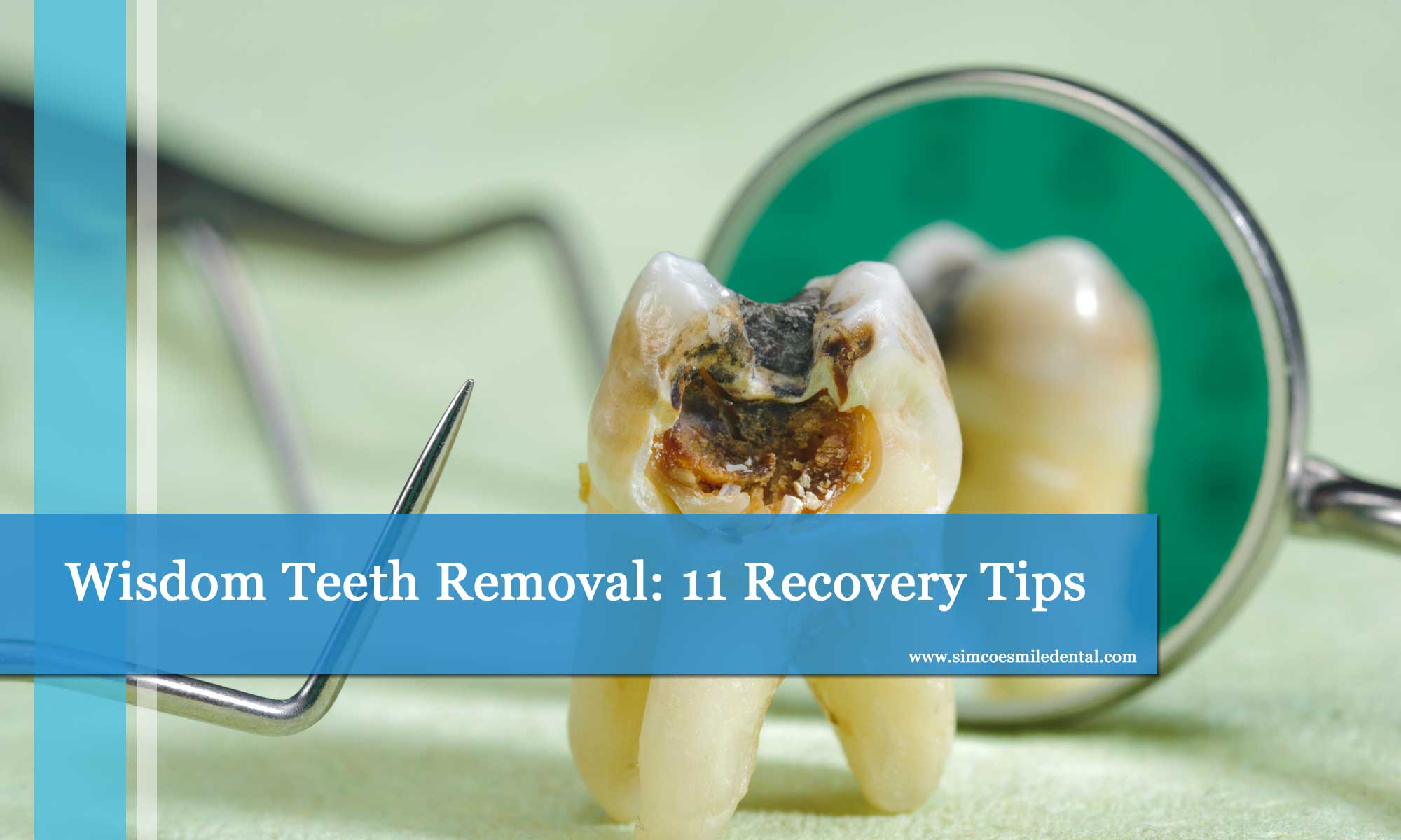 Wisdom Teeth Removal Recovery Time - Face Surgery