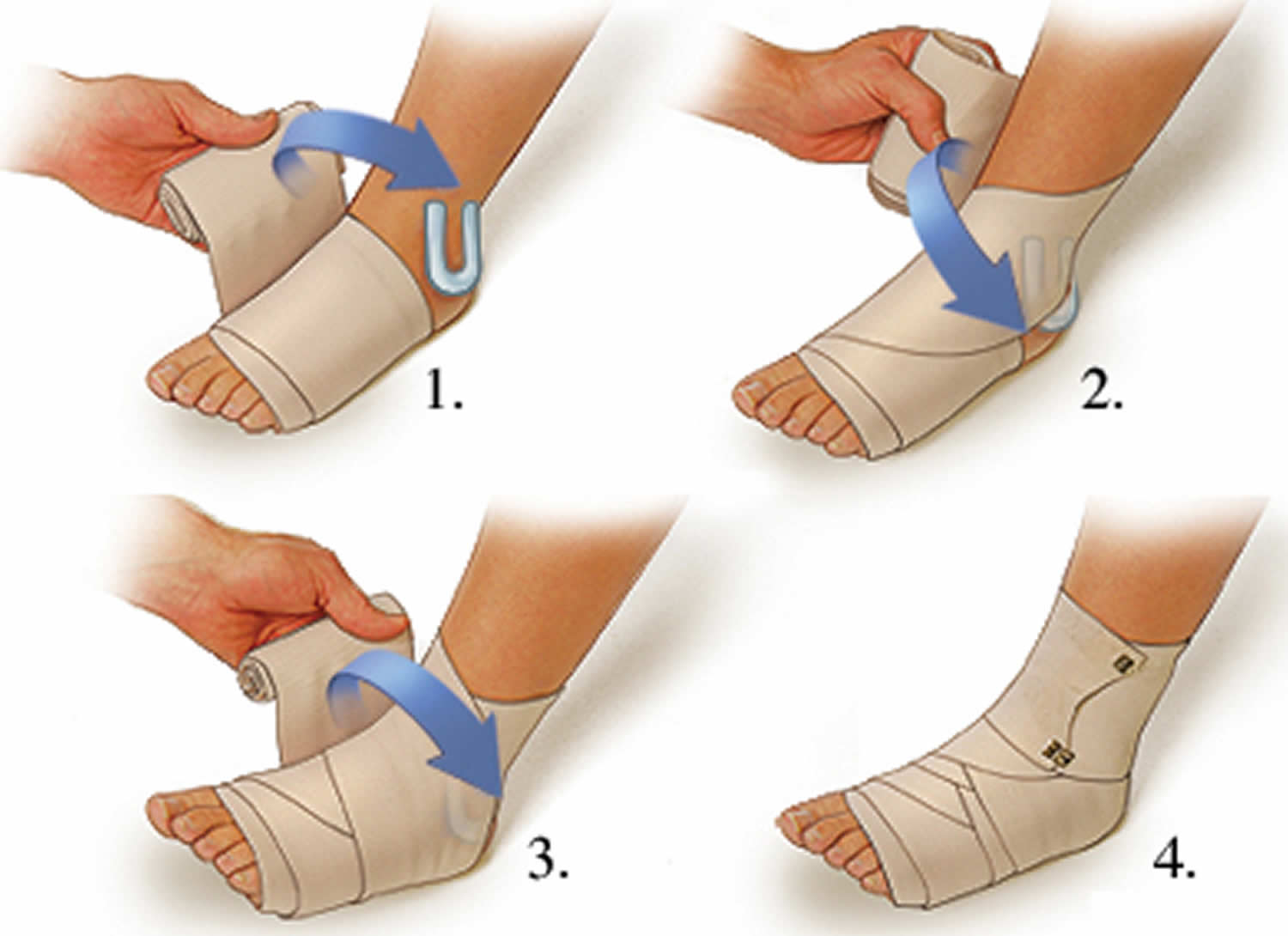 Wrap A Twisted Ankle