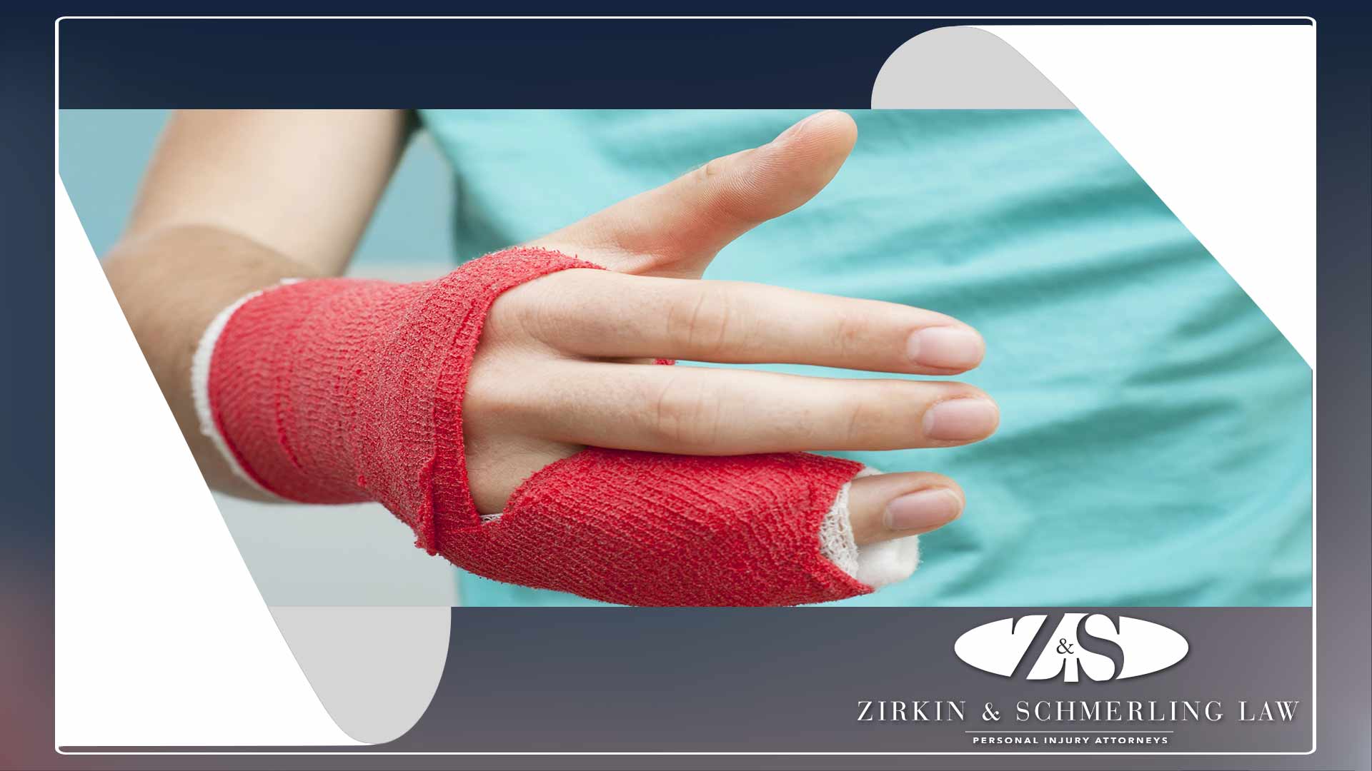 Wrist Blood Vessel Burst