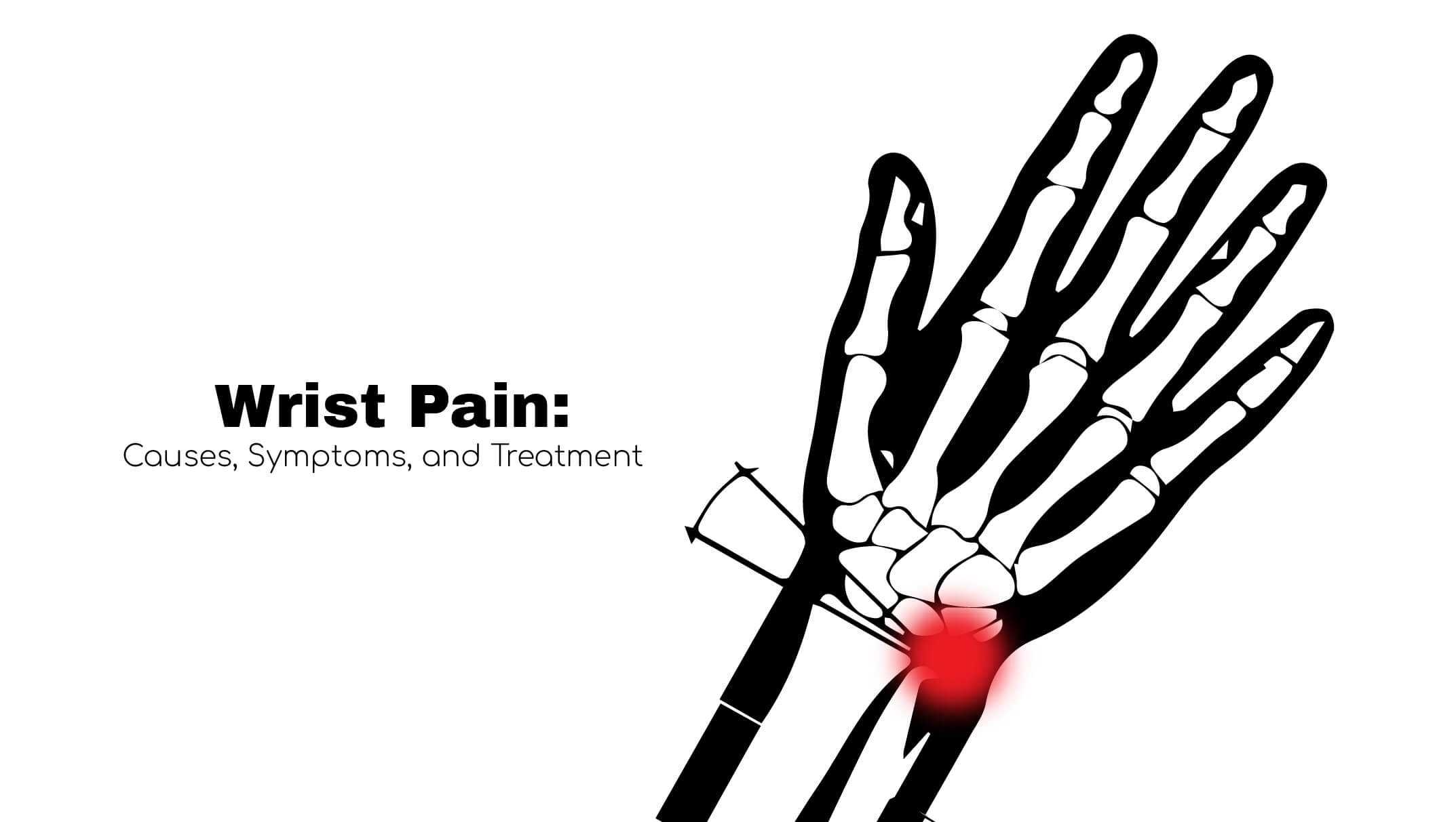 Wrist Pain Outer Wrist