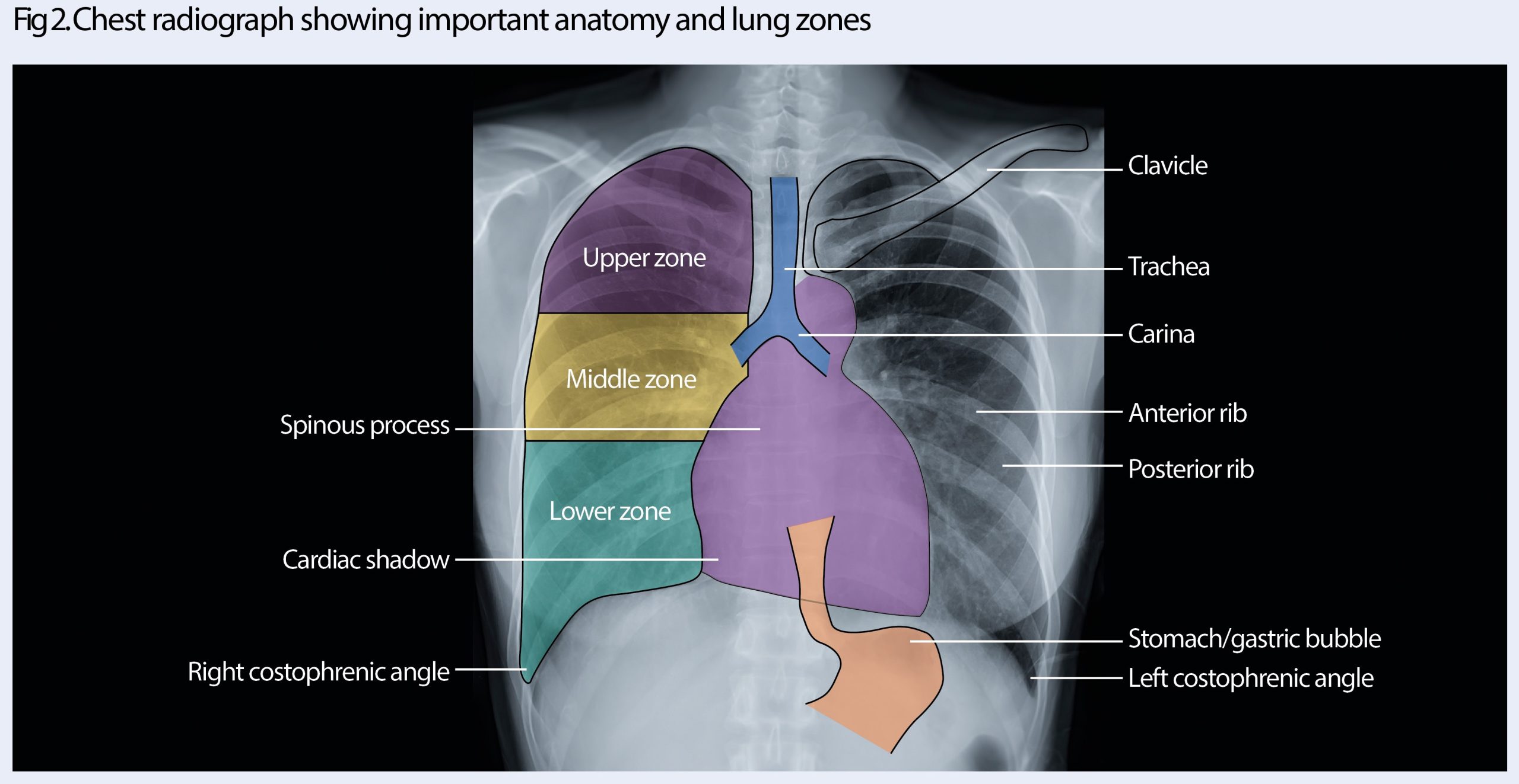 Xray Anatomy